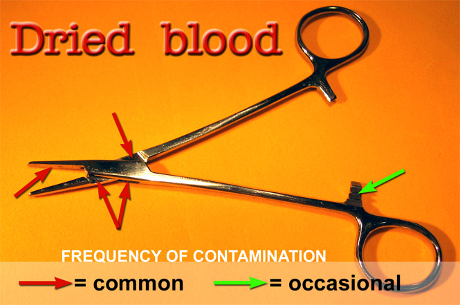 A medical instrument contaminated with blood from a prior patient